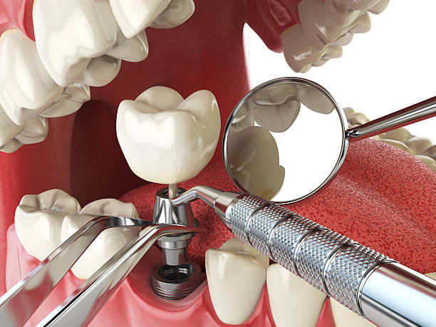 Best Emergency Root Canal Treatment in Douglas, GA